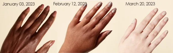 ATTDX Lightens AcanthosisNigricans TherapyOil - Image 3