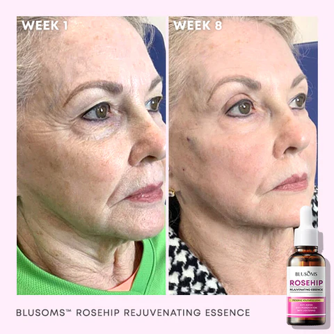 Blusoms™ Rosehip Rejuvenating Essence - 3. irudia