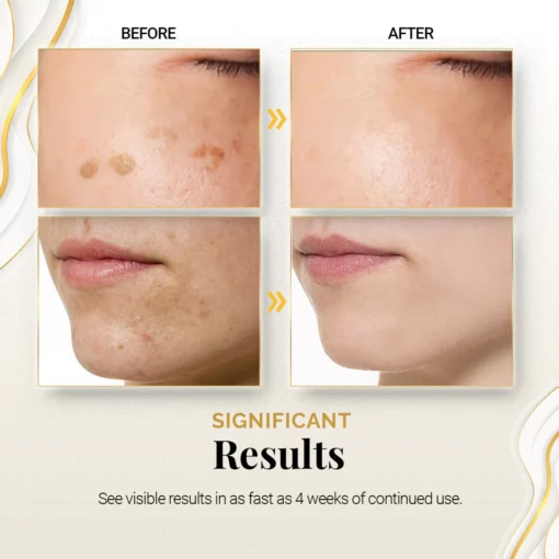 PureBright High-Efficiency Corrective Whitening Spot Cream