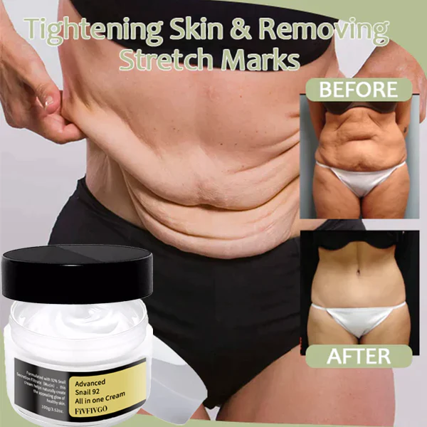Fivfivgo Koreanisches Schneckenkollagen Lifting & Straffende Krpercreme