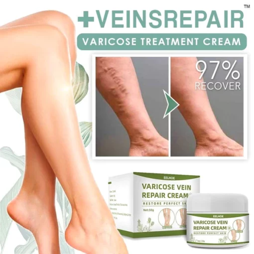 Varicose Treatment Cream