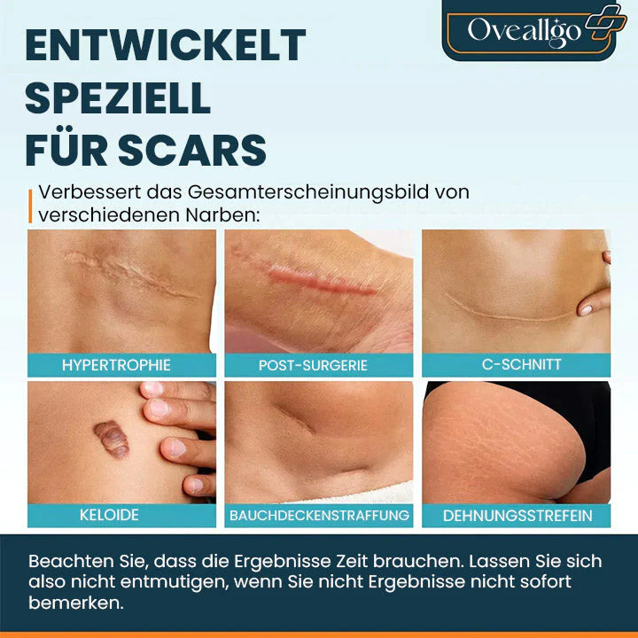 Oveallgo ScarAway Ultimativ Fortschrittliches Narbengel