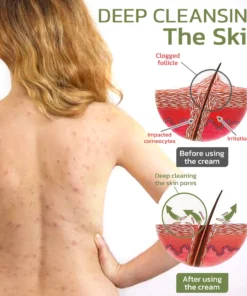 Alternative view of flysmus™ KeratosisTreat Deep Clean Smooth Cream