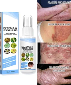 Alternative view of Herbal Psoriasis Relief Spray