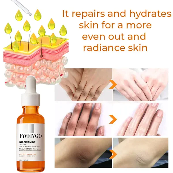 Fivfivgo Advanced Skin Brightening Serum zur Entfernung von Melanose und dunklen Flecken
