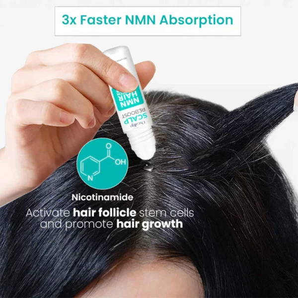 Oveallgo ScalpReboost Ultra NMN Hair Growth Roller
