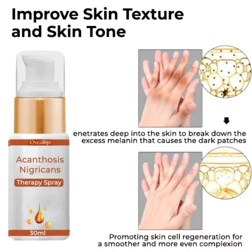 Oveallgo™ Acanthosis Nigricans Therapy Spray - Ofbylding 4
