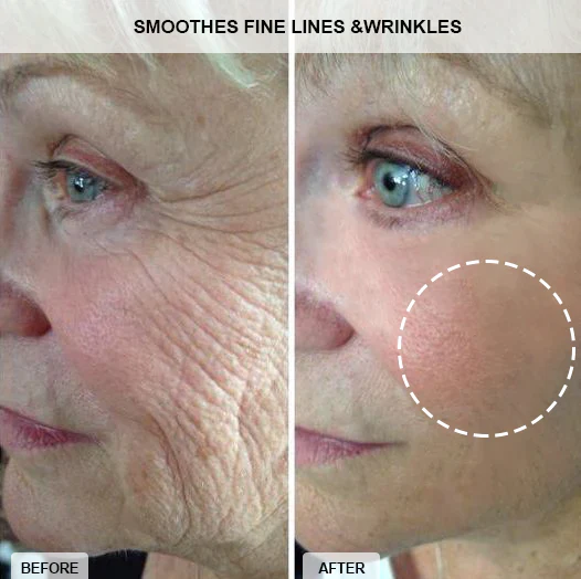 Fivfivgo Collagen-Boost Lift Anti-Aging Cream