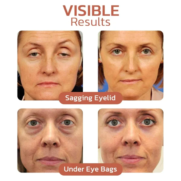 Crocodile Oil Healing & Repairing Eye Cream - Image 5