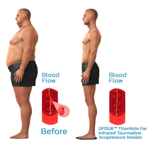 GFOUK TitanVein Far Infrared Tourmaline Acupressure Insoles