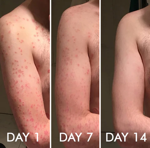AEXZR™ Skin Repair Cream - Ofbylding 5