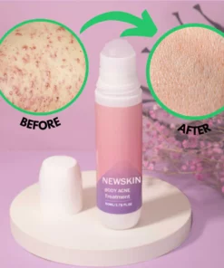 Alternative view of NEWSKIN™ Pimple & Acne Treatment Roll On Serum