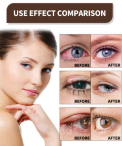 Fivfivgo™ EYELIGHT Ultra Eye Therapy Lubricant Eye Drops