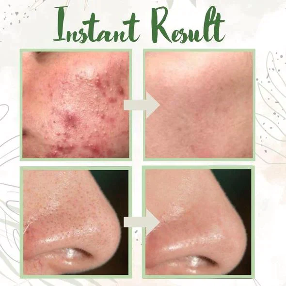 Peel-Facial Cleaning Non-Pore Mask