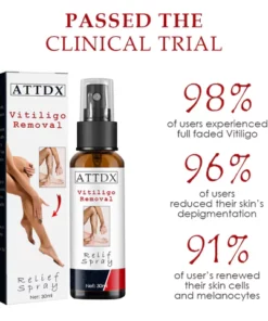 VitiligoRemoval Relief Spray
