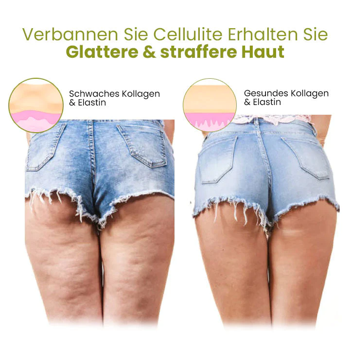 Oveallgo HerbalFirm PURE Wunder Cellulite Reduktion Pflaster