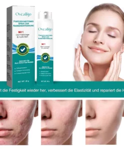 Alternative view of Oveallgo™ LUX Fortgeschrittenes Spray zur Narbenentfernung