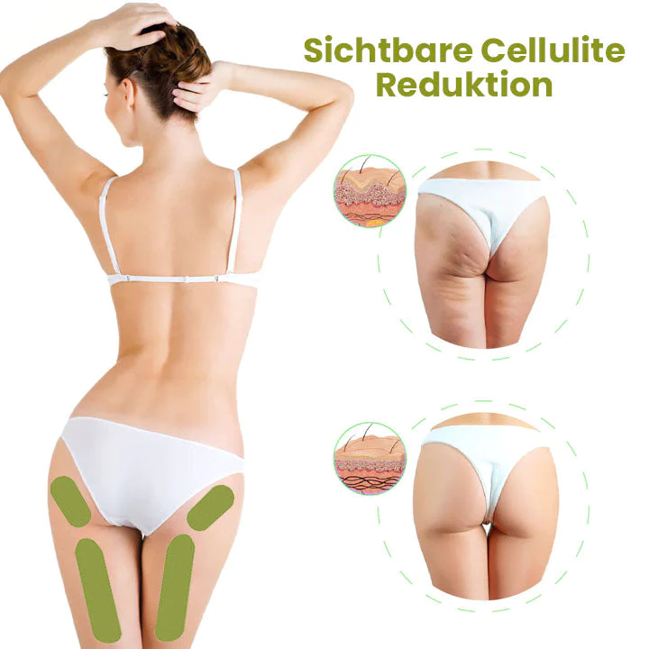 Oveallgo HerbalFirm PURE Wunder Cellulite Reduktion Pflaster