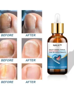Alternative view of NailX™ Toenail Fungus Care Gel Extra Strength
