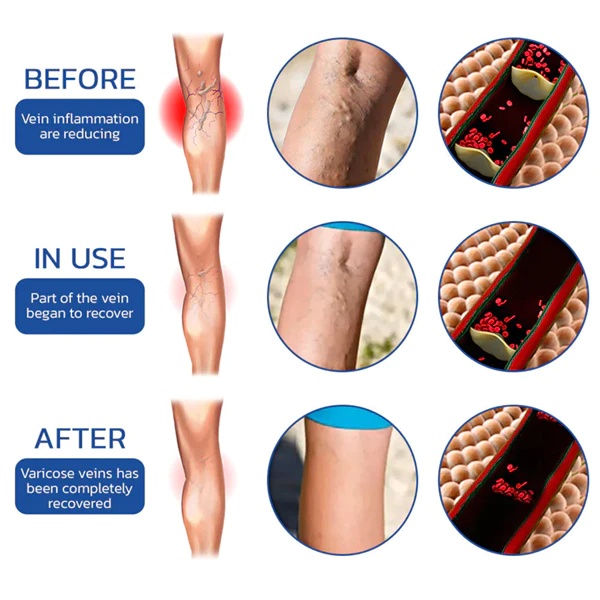 Fivfivgo UltraSLIM Tourmaline Ion Body Shaping Stretch-Seidenstrmpfe