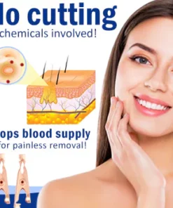 Wart Removal Sterile Clip