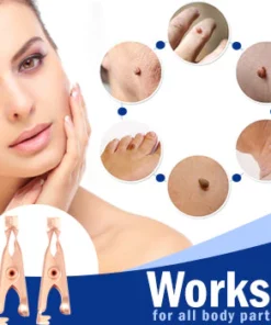 Wart Removal Sterile Clip