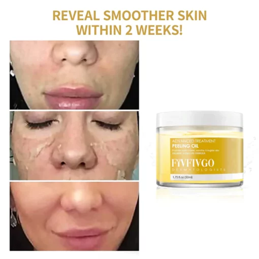 Fivfivgo™ 30 दिन एंटी-रिंकल एक्सफोलिएट पीलिंग ऑयल - छवि 2