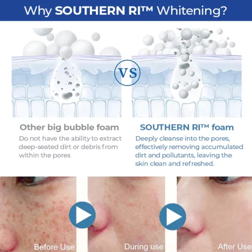 SOUTHERN RI Whitening Freckle Removal Cleanser