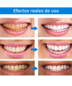 Alternative view of Lanthome™ Esencia blanqueadora de dientes