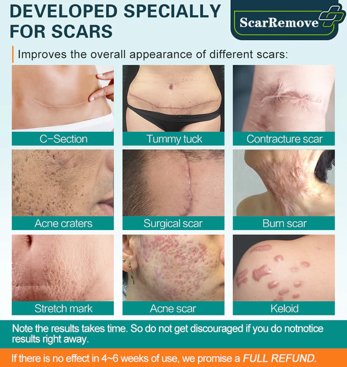 KlearScar Advanced scar removal gel
