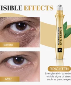 Alternative view of Golden Soothing Rolling Eye Serum