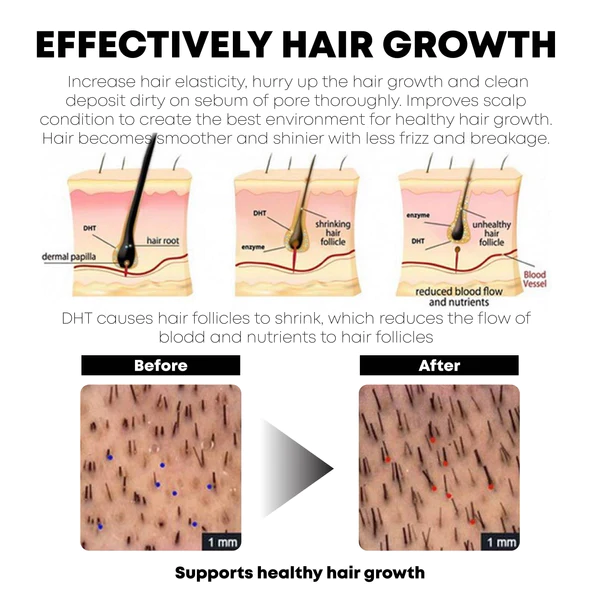 ATTDX HairRegrowth Rice Essence ShampooBar - Image 6