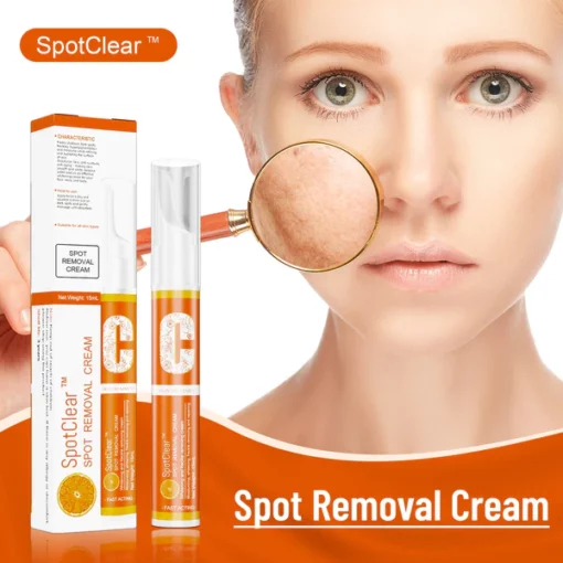 SpotClear™ Spot Removal Cream