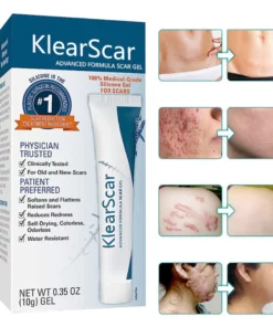 KlearScar™ Advanced scar removal gel