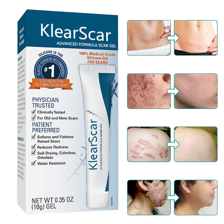 KlearScar Advanced scar removal gel