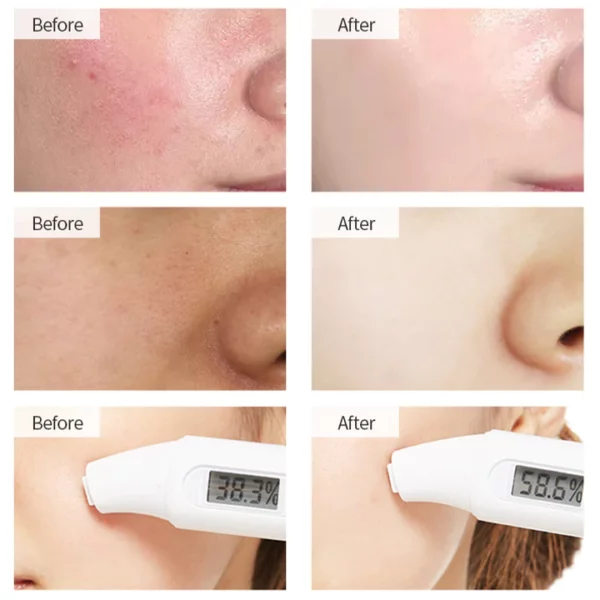 ProRegen Medical Skin Repair Cold Compress Mask