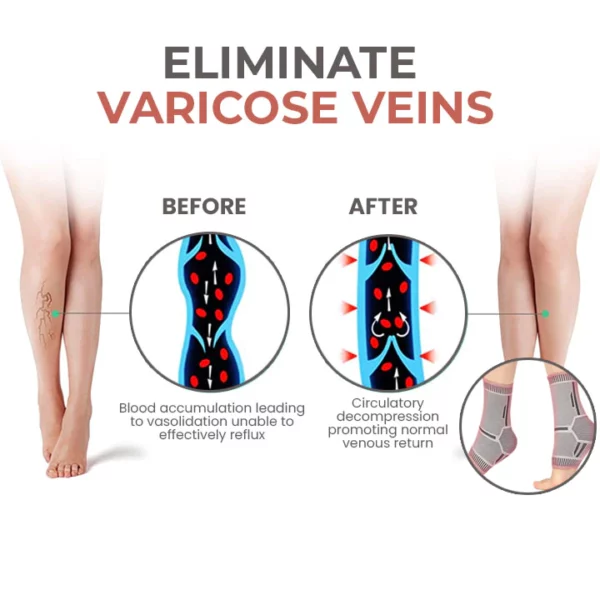 Oveallgo Self-Heating Tech Anti Edema Compression Socks