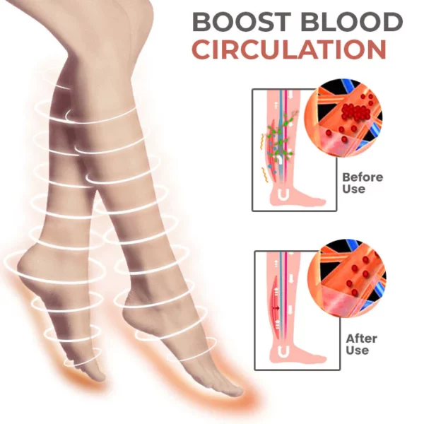 Oveallgo Self-Heating Tech Anti Edema Compression Socks