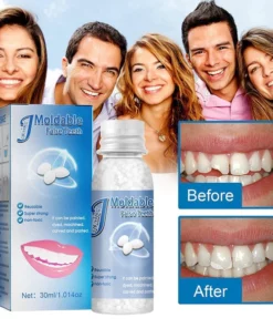 Oveallgo™ Tooth Repair Granules