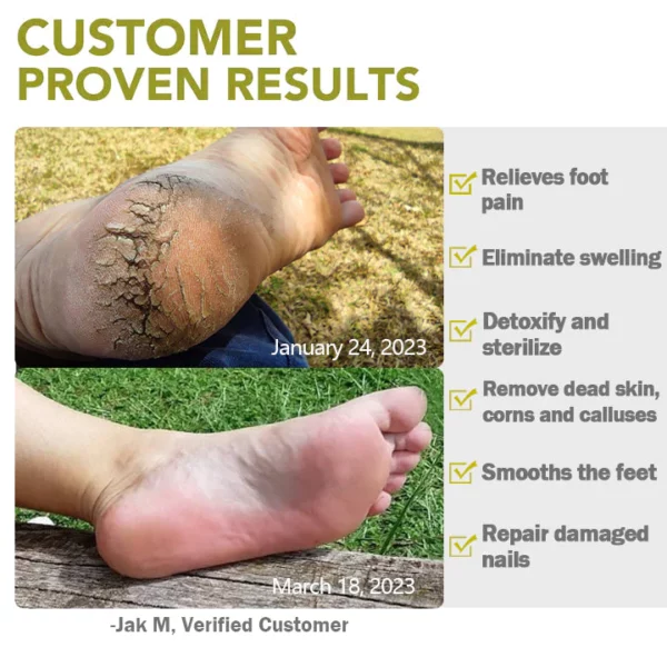 Clàran èifeachdais CC ™ FootBath Oil Essential - Ìomhaigh 6