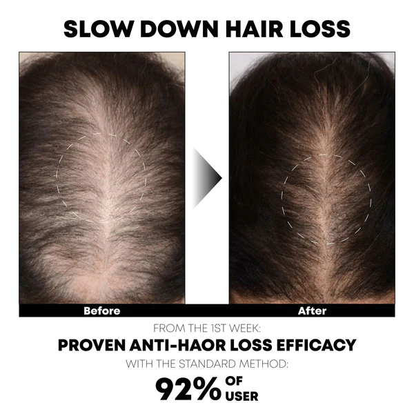 ATTDX HairRegrowth Rice Essence ShampooBar - Image 7