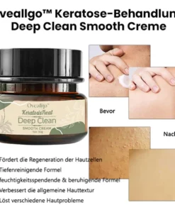 Alternative view of Oveallgo™ Keratose-Behandlung Deep Clean Smooth Creme