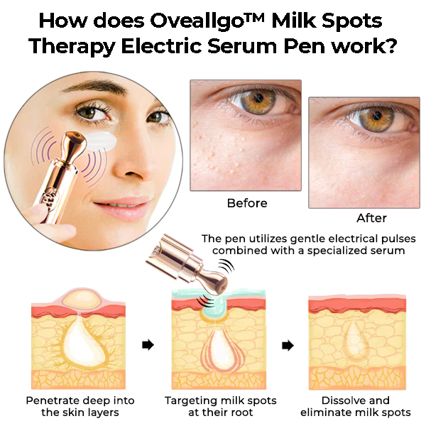 Oveallgo Milk Spots Therapy Electric Serum Pen