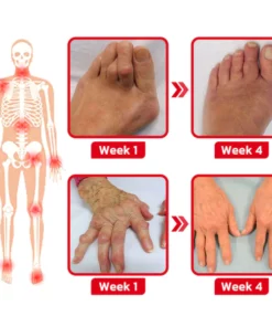 Alternative view of GFOUK™ JointMax Therapie- und Entzündungshemmendes Gel