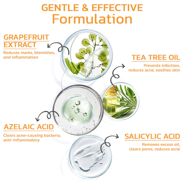 GFOUK FAFASKIN Rckenflecken und Akanthose Nigricans Reinigungslotion