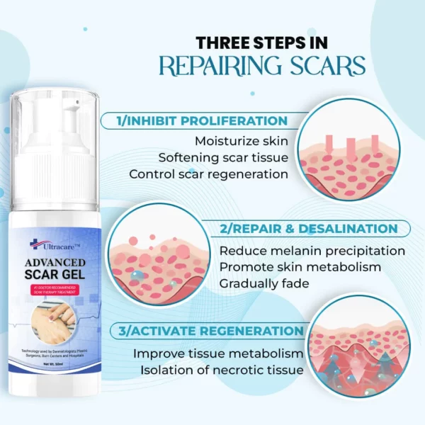 Ultracare™ Advanced Scar Gel - Image 7
