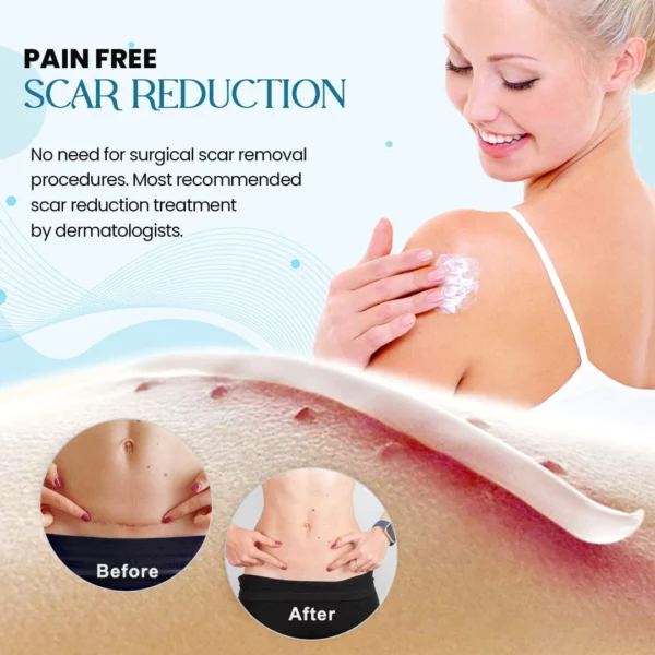Ultracare™ Advanced Scar Gel - Image 4