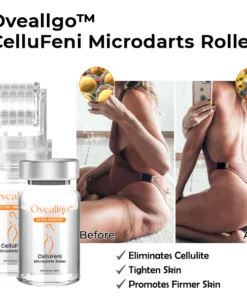 Alternative view of Oveallgo™ CelluFeni Microdarts Roller