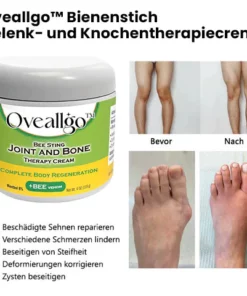 Oveallgo™ Bee Sting Gelenk PURI - und Knochentherapiecreme – vollständige Körperregeneration