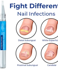 Alternative view of LEFUN Removal Paronychia Gel